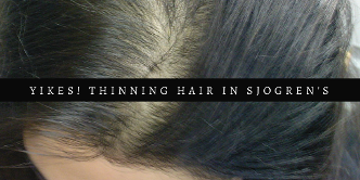 Sjogren's Syndrome info